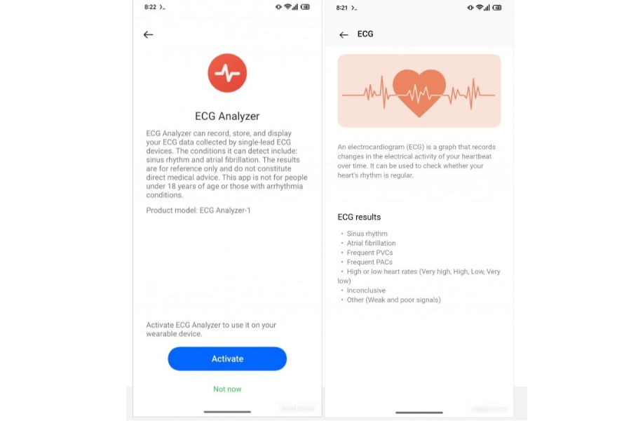 OnePlus Watch 3 ECG Feature